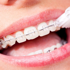 ortodoncja-nowe